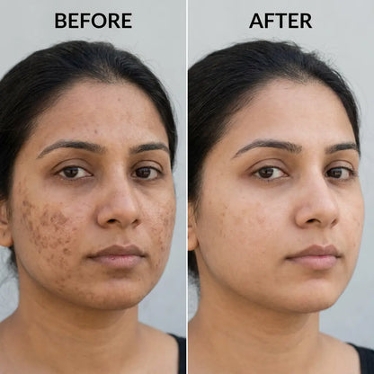 Zameora™ Advanced Scar Gel